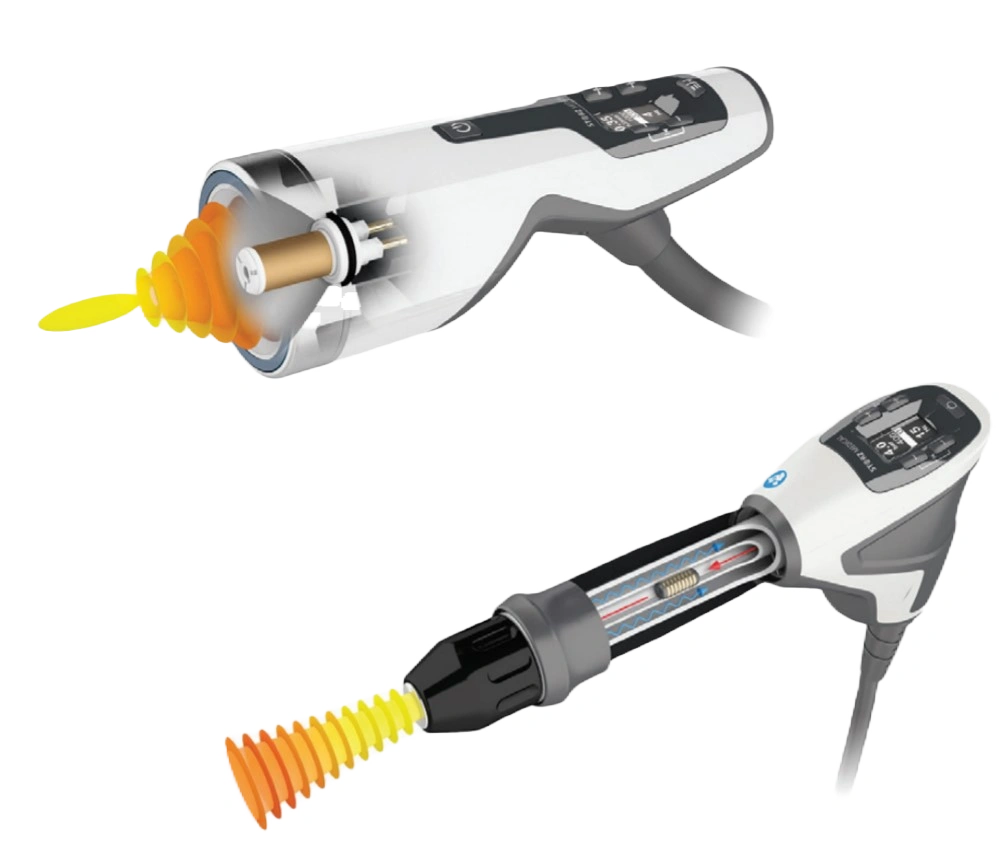 Extracorporeal Shockwave Therapy for ED